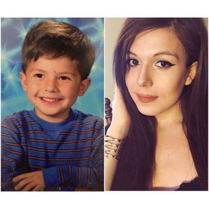 Blaire White Before And After Photos Plastic Surgery 2023