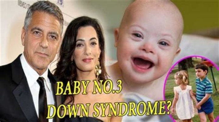 Understanding The Truth Does Clooney's Child Have Down Syndrome?
